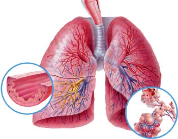 Лечение лучевых повреждений легких (лучевого пульмонита и пневмонита)