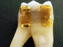 Технологичная &quовитатуировка на зубе&quжен ставит диагноз по дыханию