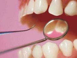 Найдены рациональные условия для выращивания зубов из стволовых клеток зубного зачатка