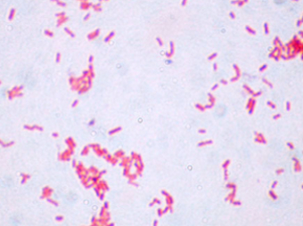 Разработаны скоростные тесты на устойчивость кишечных бактерий к антибиотикам