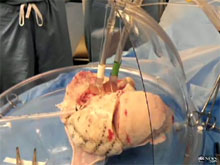 Трансплантологи научились доставлять пациенту донорские органы &quзывживыми&quмоз