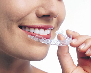 Брекеты помогут обрести красивые зубы и лучезарную улыбку