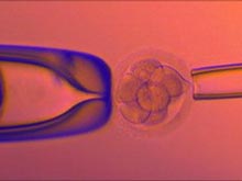 &quкоеКлеточный мусор&quтур подскажет, есть ли у эмбриона отклонения
