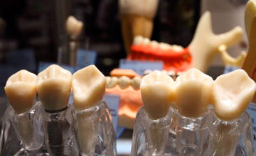 Через несколько лет «био-зубы» придут на смену имплантам