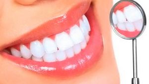 Скидки на исцеление зубов, чистку ультразвуком и имплантацию от стоматологии ДЕНТЕССА 