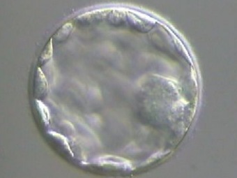 Европейский суд запретил патентовать методики исследования клеток эмбрионов