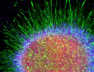 Стволовые клетки для лечения лейкозов можно производить в лаборатории 