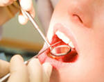 Пирсинг на языке вреден для зубного здоровья 
