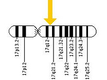 Ген BRCA1 признан &quО Суниверсальным&quНОЙ раковым геном