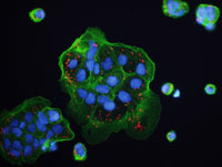 Иммунная клетка убивает себя, чтобы помочь уничтожить бактерию