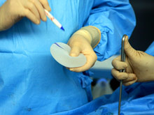 Пластическая операция на груди нередко заканчивается смертельным раком