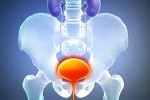 FDA одобрило оксибутинин в форме геля для внешнего применения для лечения гиперактивности мочевого пузыря