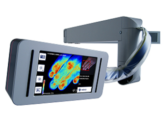 Разработана лазерная доплерография для диагностики ожогов в реальном времени