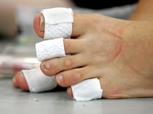 Липосакция пальцев ног опережает по популярности стандартные процедуры