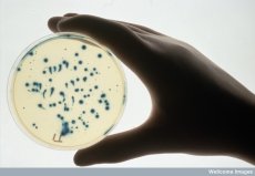 В Израиле зарегистрирован 1-ый случай невосприимчивой почти ни к каким антибиотикам бактерией-мутантом