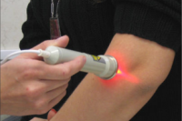 Лазерная терапия может стать новым средством лечения наркомании