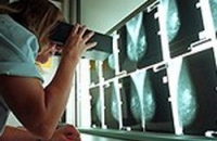 Шведские учёные: маммография спасает жизнь