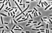 Выяснилось, как бактерии выводят из строя медицинские устройства