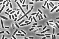 Выяснилось, как бактерии выводят из строя медицинские устройства