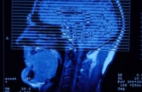 Какое зло таится в мозге: германский невропатолог нашел «темное пятно»