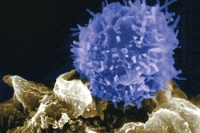 Ученые составили список самых неожиданных факторов, ослабляющих иммунную систему