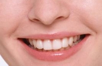ТОП-6 продуктов для здоровья зубов