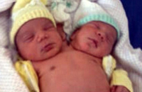 В Бразилии родился здоровый двухголовый ребенок