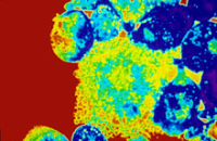 «ВИЧ-перебежчик» делает иммунитет бесполезным в борьбе с вирусом