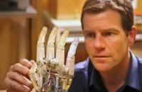 Канадский ученый работает над созданием уникального протеза руки
