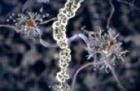 Вакцина от болезни Альцгеймера: исследования 2011