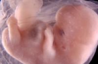 На свалке был найден 19-недельный эмбрион человека