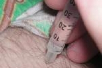 Прогресс в лечении наркозависимости Прогресс в лечении наркозависимости