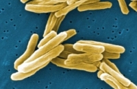 Смертность от туберкулеза в Рф снизилась за год на семь процентов