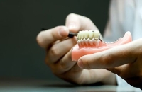 Показания и противопоказания к зубной имплантации