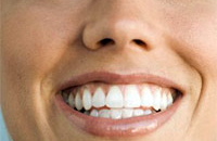 Восстановления зубов и улыбки в целом
