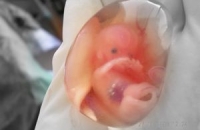 Европа против экспериментов с эмбрионами!
