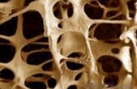 Длительное применение препарата деносумаба для лечения остеопороза