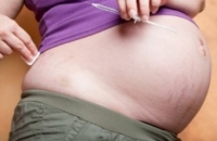 Диабет у беременных вчетверо повышает риск дефектов плода
