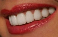 Особенности и разновидности отбеливания зубной эмали