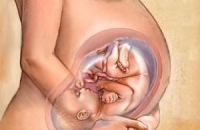 Кесарево сечение – легче для матери, но небезопасны для ребенка