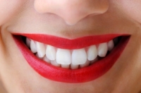 Как провести безопасное отбеливание зубов?