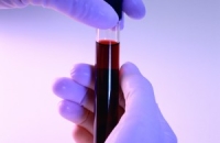 В Рф необходимо создание единой сети банков стволовых клеток пуповинной крови