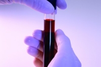 В Рф необходимо создание единой сети банков стволовых клеток пуповинной крови