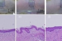 Разработан гибридный каркас для инжиниринга кожных тканей