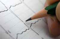 Новенькая эра в профилактике инсульта у пациентов с мерцательной аритмией Новенькая эра в профилактике инсульта у пациентов с мерцательной аритмией