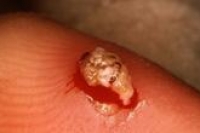 Тяжелое паразитарное болезнь охватило 12 районов Уганды и унесло жизни уже более 20 человек Тяжелое паразитарное болезнь охватило 12 районов Уганды и унесло жизни уже более 20 человек