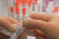 В Югре за два года выполнено 20 операций трансплантации стволовых клеток В Югре за два года выполнено 20 операций трансплантации стволовых клеток