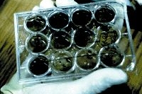 Французские ученые определили штамм бактерии E.coli Французские ученые определили штамм бактерии E.coli