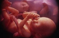 Рак связан с эмбриональным развитием, заявили ученые