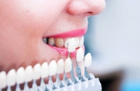 Зубные импланты. Особенности и правила выбора